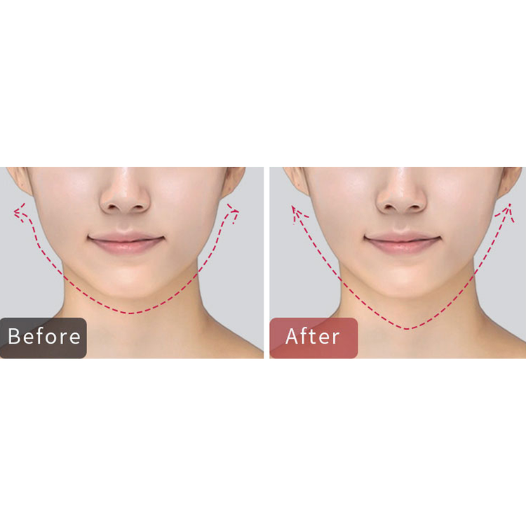 GlasSkin™ Redux V - Microcurrent Facial Toning Device